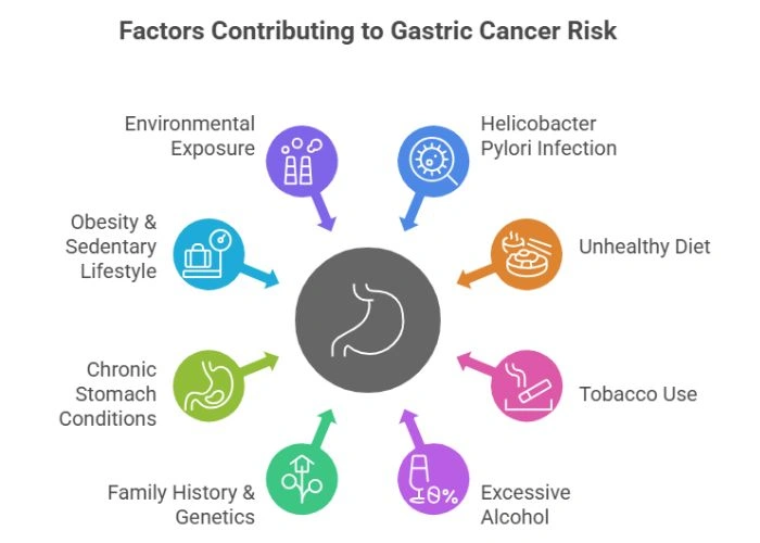 Causes of Gastric Cancer